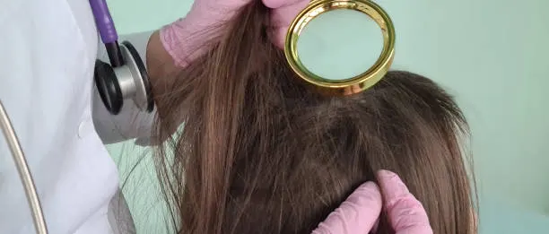 Alergi terhadap produk rambut