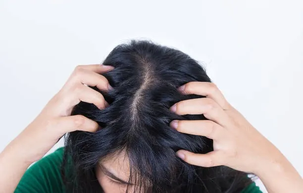 Penumpukan Residu Produk Rambut