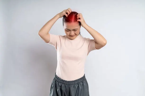 kulit kepala iritasi