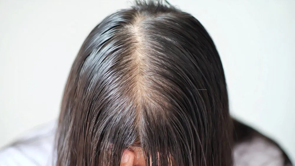 Produk Perawatan Rambut yang Ampuh Lawan Kebotakan: Solusi Anti Botak dengan Gaya Santai