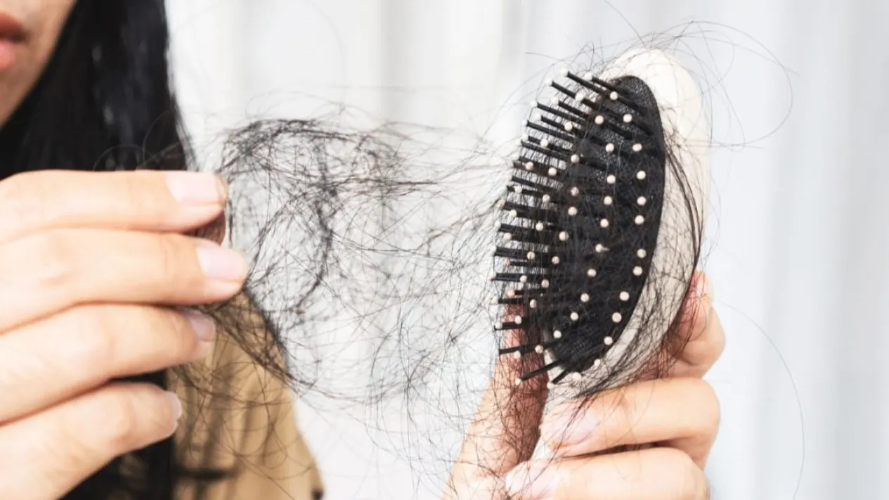 Ketombe dan Rambut Rontok: Saling Terkait atau Cuma Kebetulan?