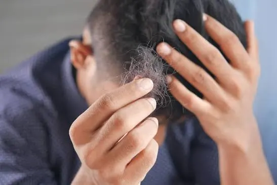 Hati-hati, Kebiasaan Ini Bisa Merusak Akar Rambut Anda
