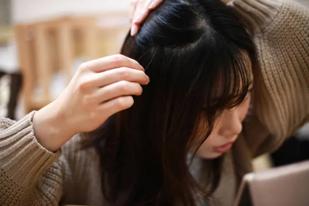 Kekurangan Rambut di Area Tertentu: Penyebab, Pencegahan, dan Cara Merawatnya