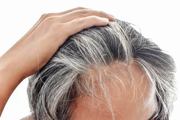 Rambut Beruban di Usia 20-an? Ini Penyebab & Cara Mengatasinya!
