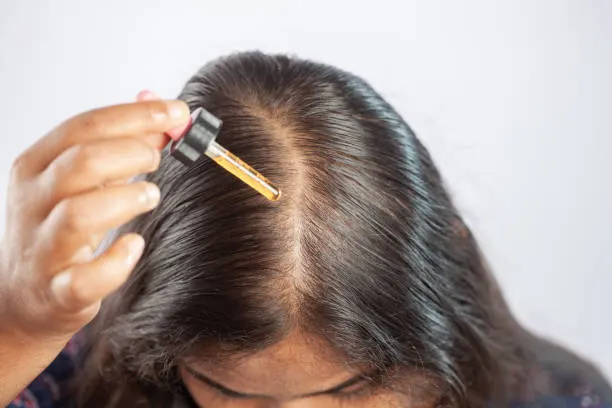 5 Kesalahan Saat Menggunakan Vitamin Rambut yang Harus Dihindari