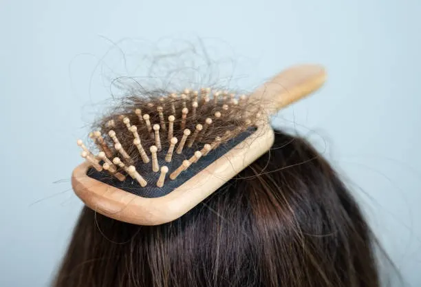 Kulit Kepala Tidak Sehat Bisa Menyebabkan Rambut Rontok: Penyebab, Ciri-Ciri, dan Cara Mengatasinya